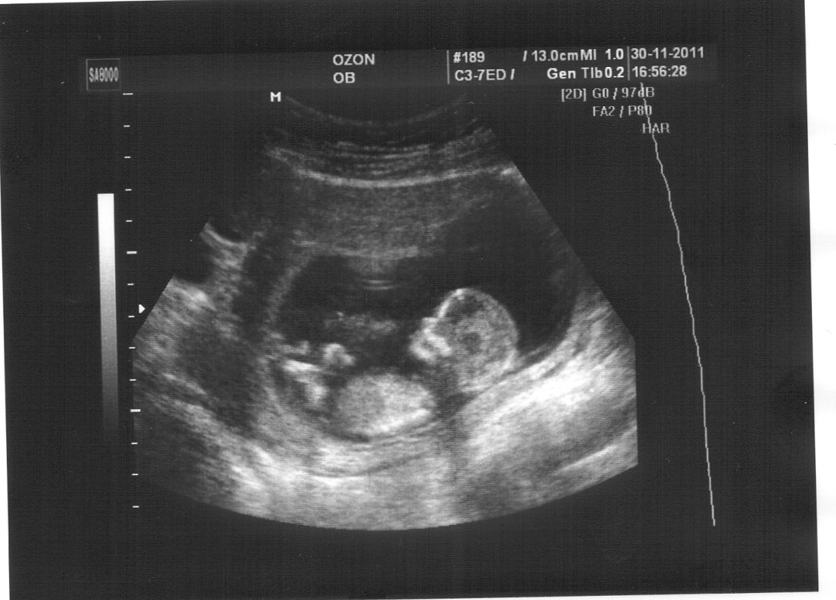 Снимок с УЗИ для беременной женщины
