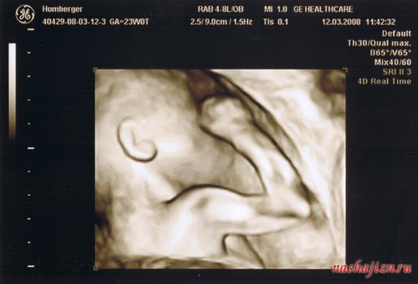 Снимок эмбриона на УЗИ