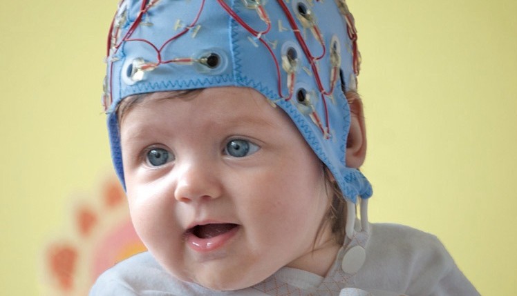 Ребенок в шапочке для нейросонографии