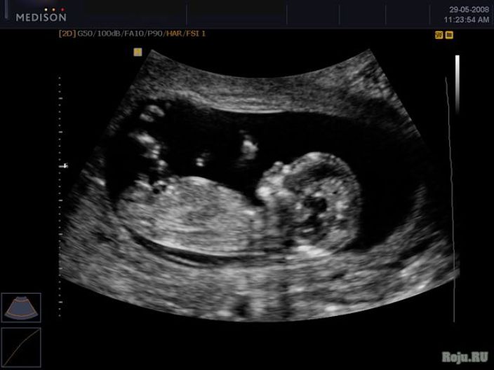 Эмбрион на 12 неделе