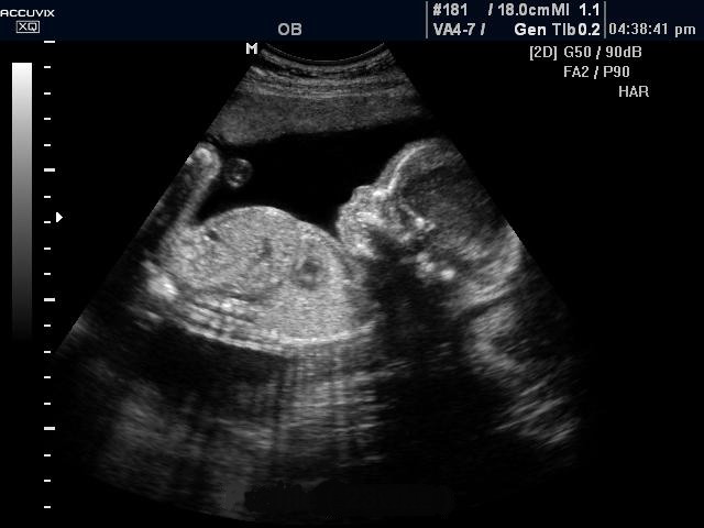 Эмбрион в матке