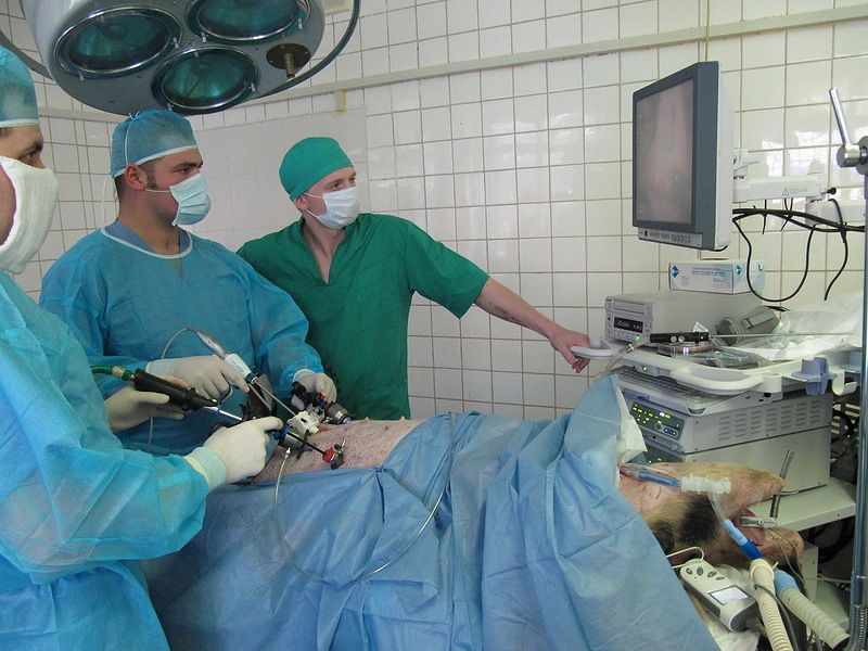 Операция лапароскопии на экране