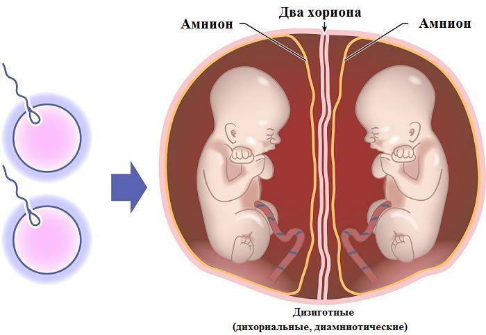 Схема близнецов в утробе