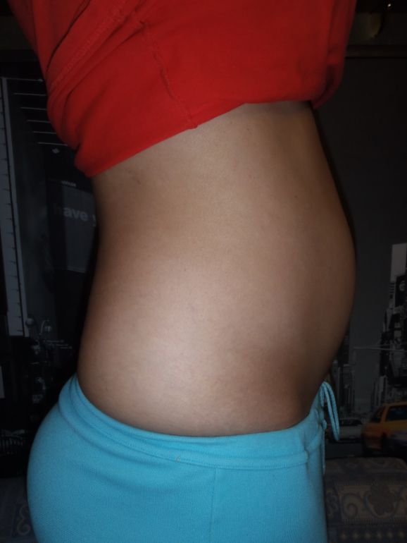 Живот на 14 неделе беременности