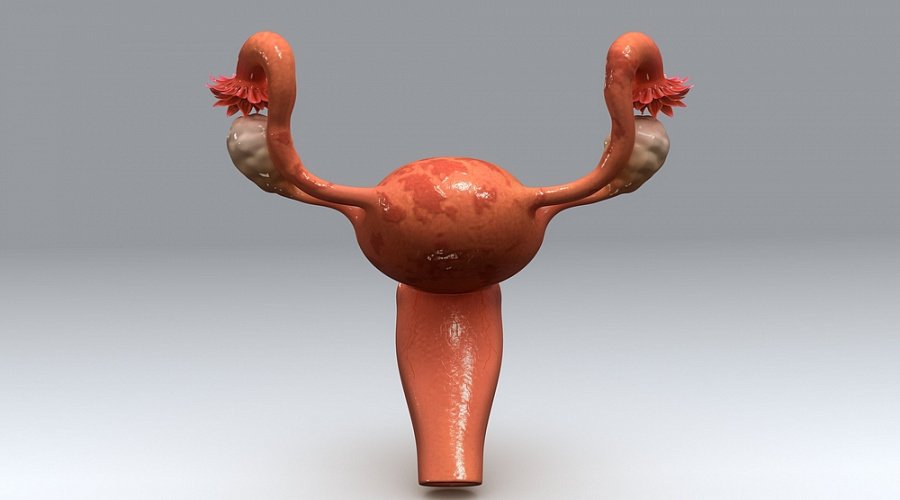 3D схема матки
