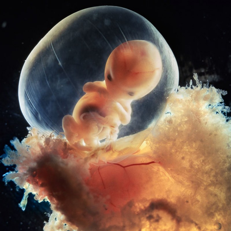 Эмбрион в плодном яйце