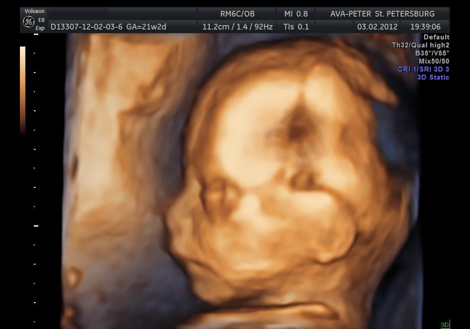 Лицо младенца в утробе на 29 неделе