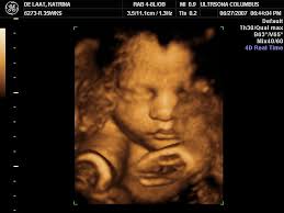 Фото с УЗ-исследования на 35 неделе беременности