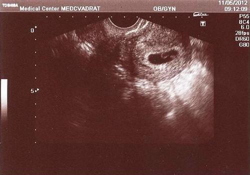 Эмбрион внутри утробы