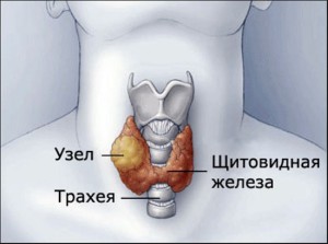 Как выглядит щитовидная железа