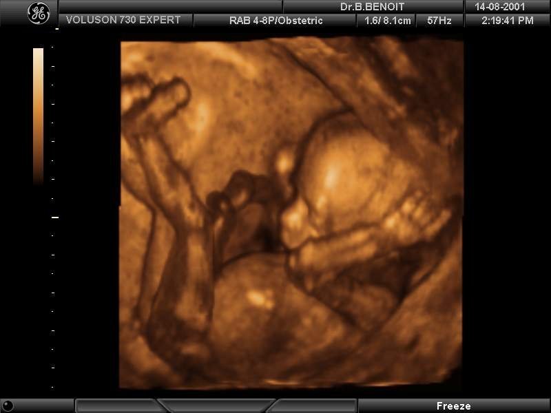Эмбрион на 16 неделе
