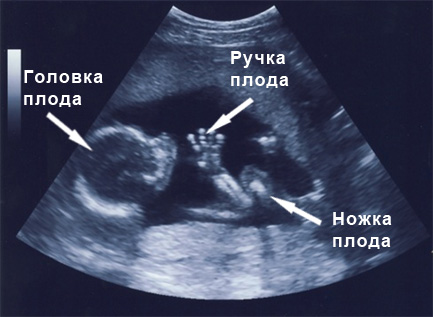 Младенец в утробе матери на  17 неделе