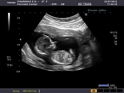 14 недель беременности что делает малыш. Фото плода, узи, фото живота женщины и видео