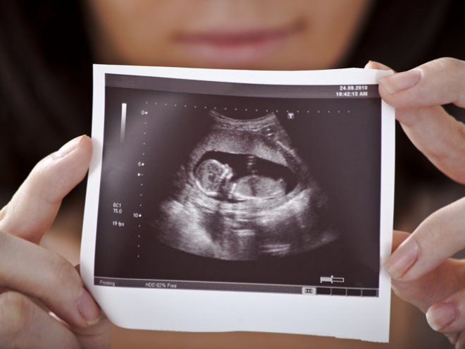 Анализ крови для подтверждения беременности thumbnail