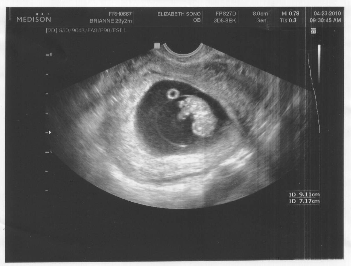 Четвертая неделя беременности от зачатия что происходит thumbnail