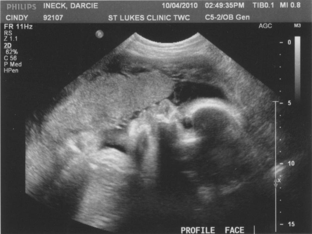 32 недели беременности вес ребенка норма таблица thumbnail